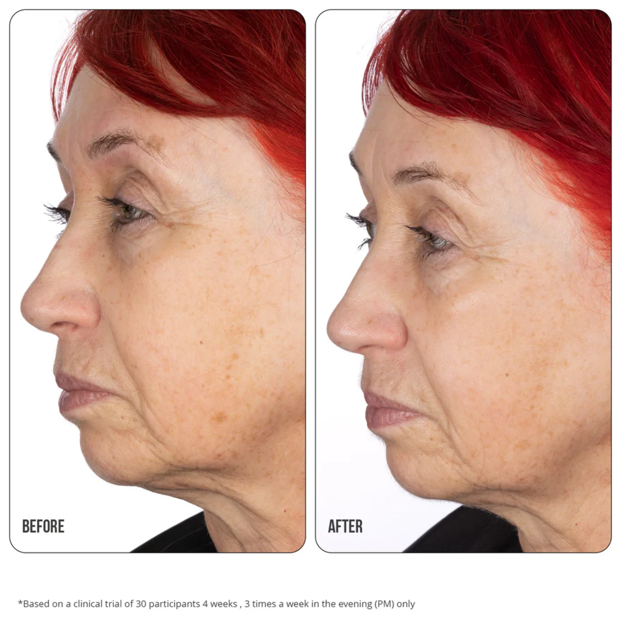 NIP+FAB - Retinol Fix Concentrate Extreme 10% - Image 4