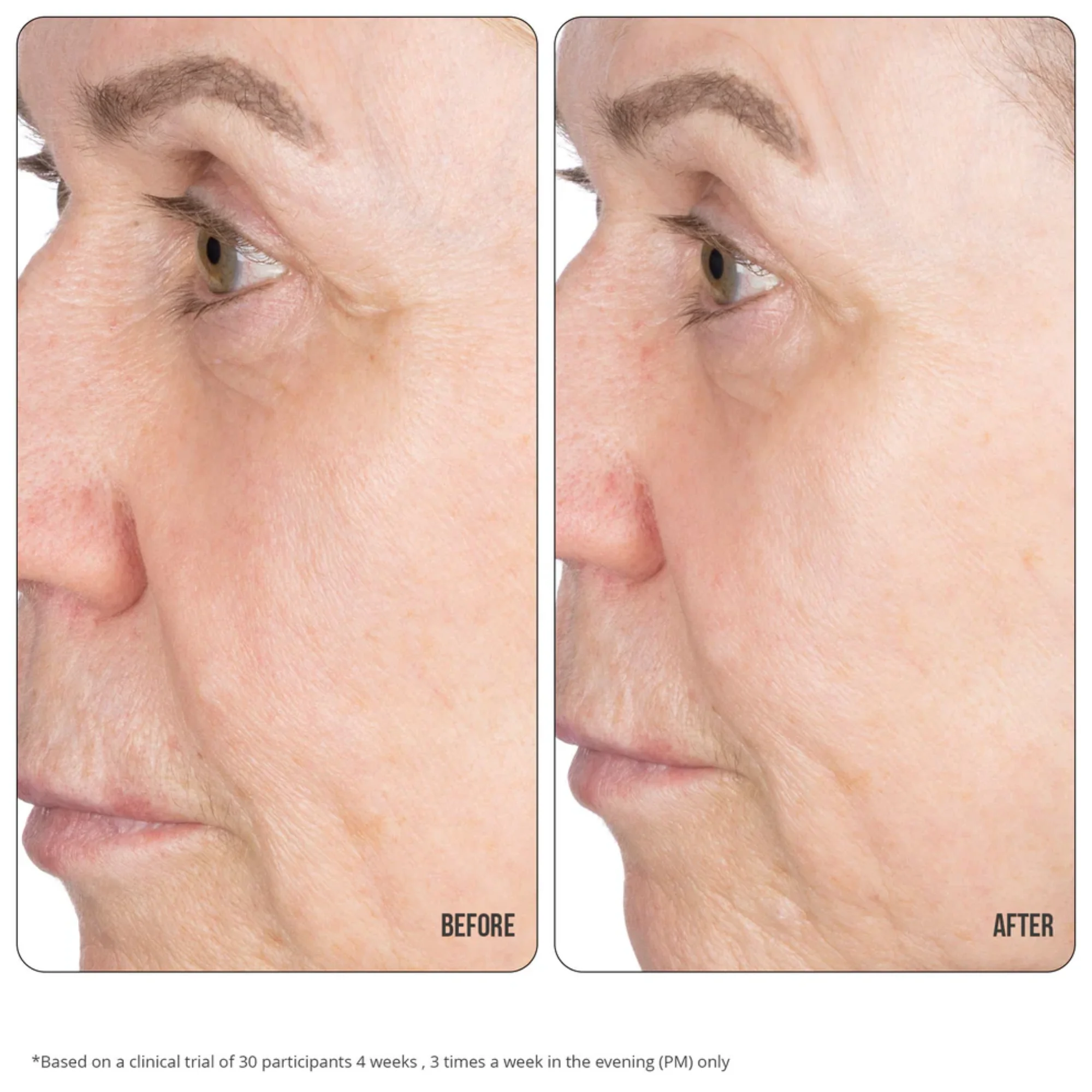 NIP+FAB - Retinol Fix Concentrate Extreme 10% - Image 5