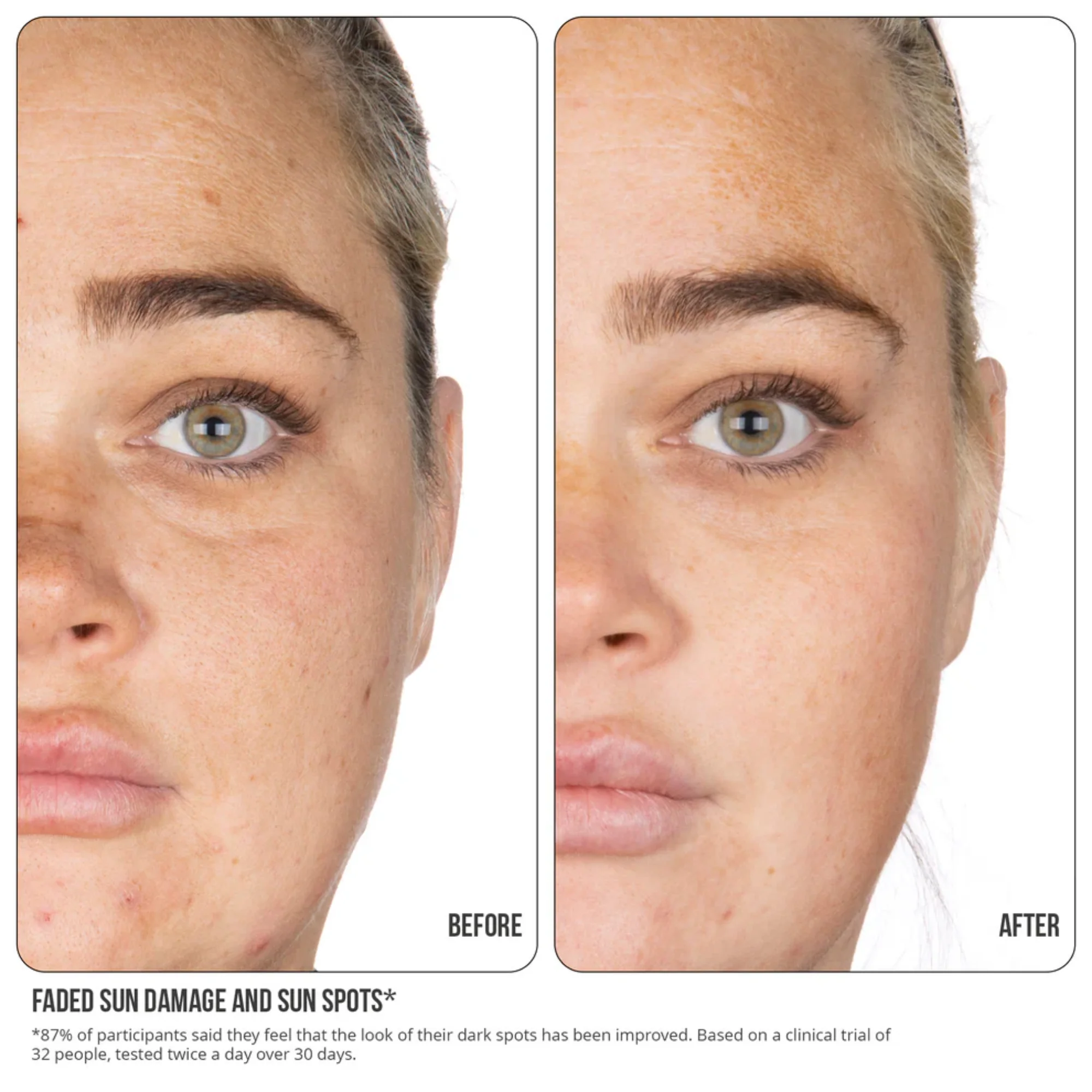 NIP+FAB - Vitamin C Fix Concentrate Extreme 15% - Image 6