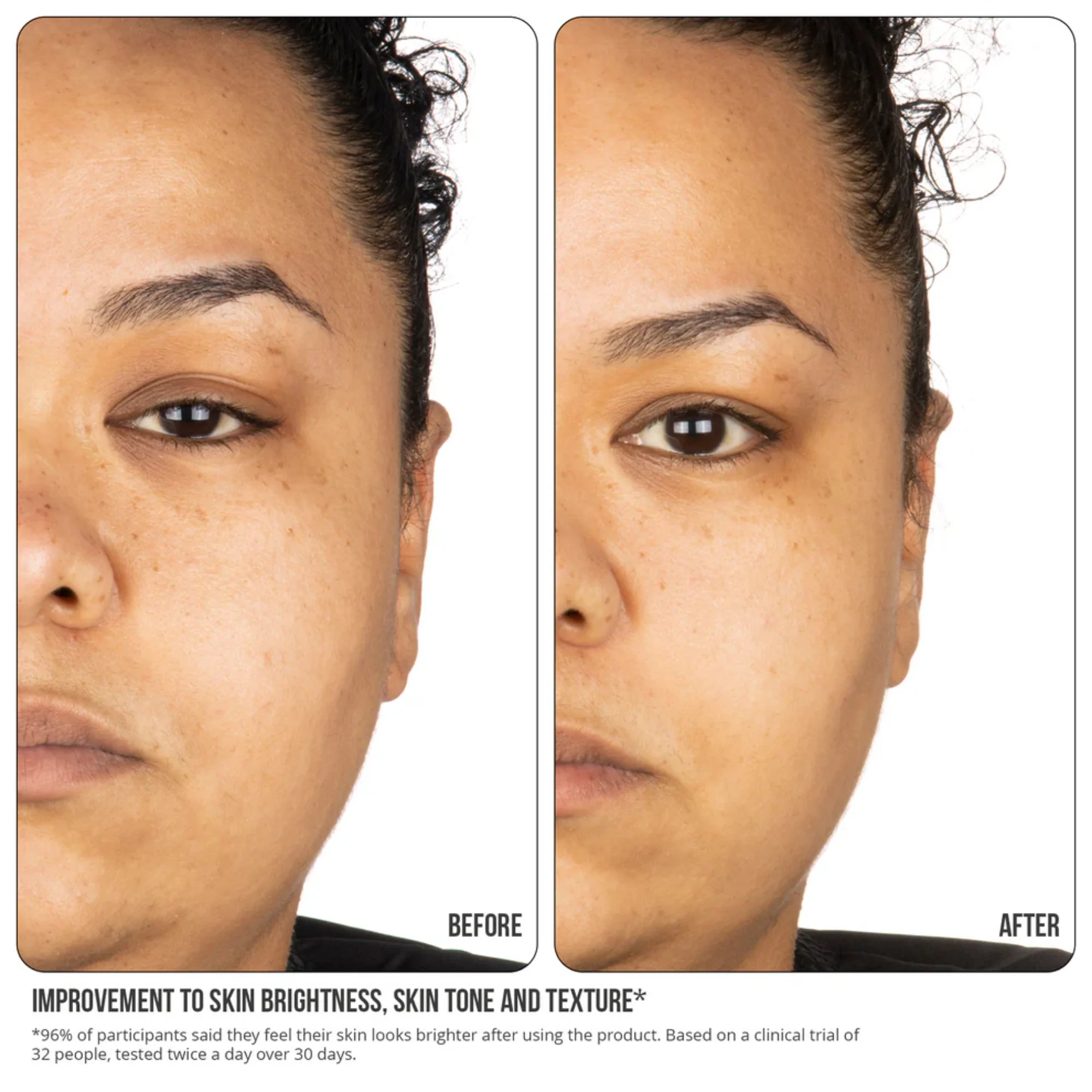 NIP+FAB - Vitamin C Fix Concentrate Extreme 15% - Image 7